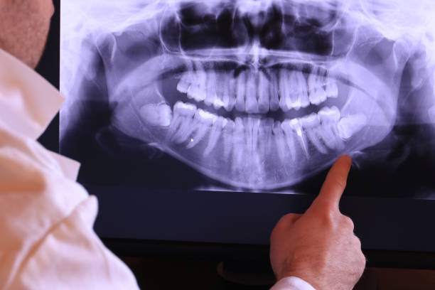 Best Emergency Treatment for Dental Infections or Abscesses in North Hills, NY
